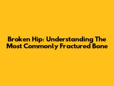 Broken Hip: Understanding The Most Commonly Fractured Bone