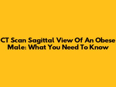 CT Scan Sagittal View Of An Obese Male: What You Need To Know