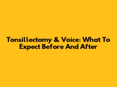 Tonsillectomy & Voice: What To Expect Before And After